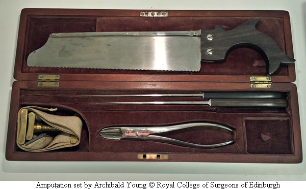amputation-set-by-archibald-young-c-royal-college-of-surgeons-of-edinburgh